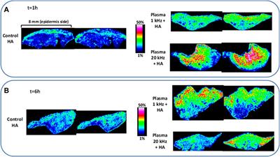 Boost of cosmetic active ingredient penetration triggered and controlled by the delivery of kHz plasma jet on human skin explants